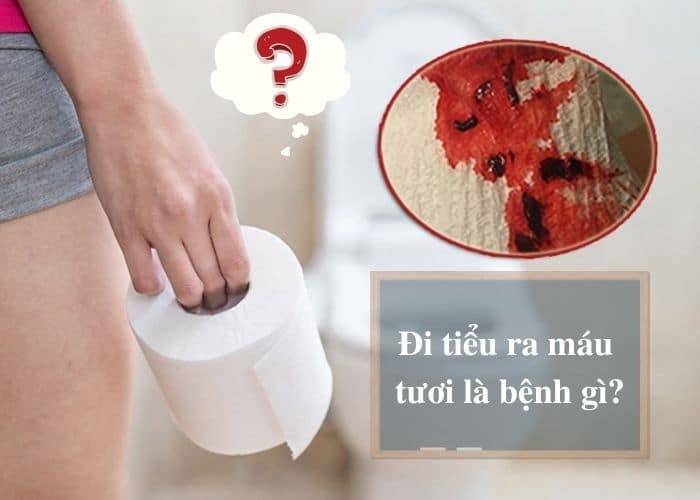 Đi tiểu ra máu tươi là bệnh gì?
