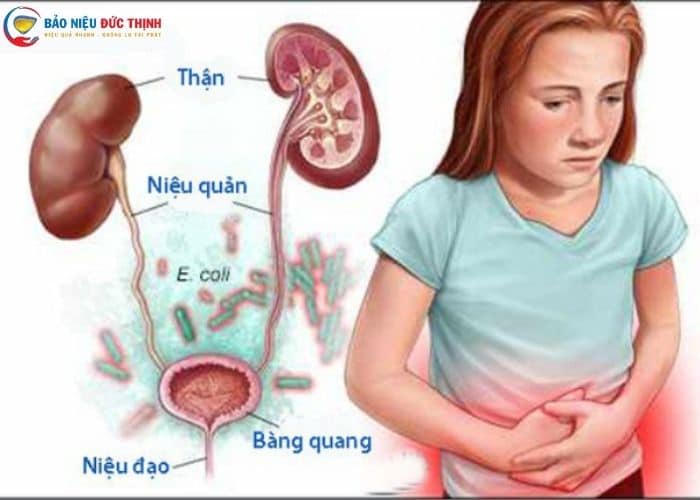 viem tiet nieu dau bung duoi lam the nao chua - [ HỎI - ĐÁP] Viêm đường tiết niệu đau bụng dưới có nguy hiểm không? Làm thế nào chữa trị?